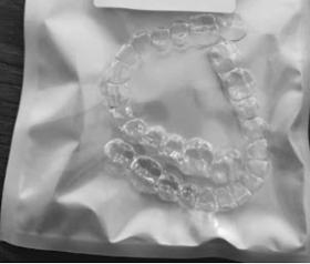 Dental aligner 